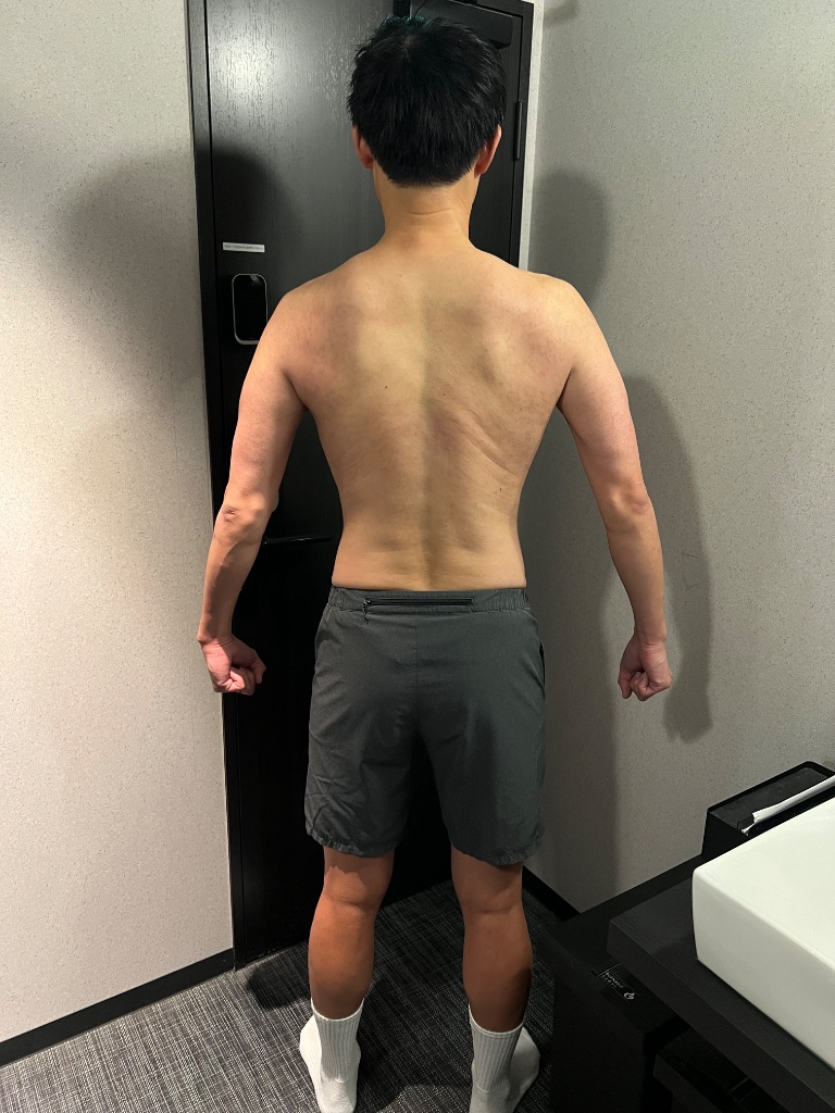 40代経営者① アフター 背面