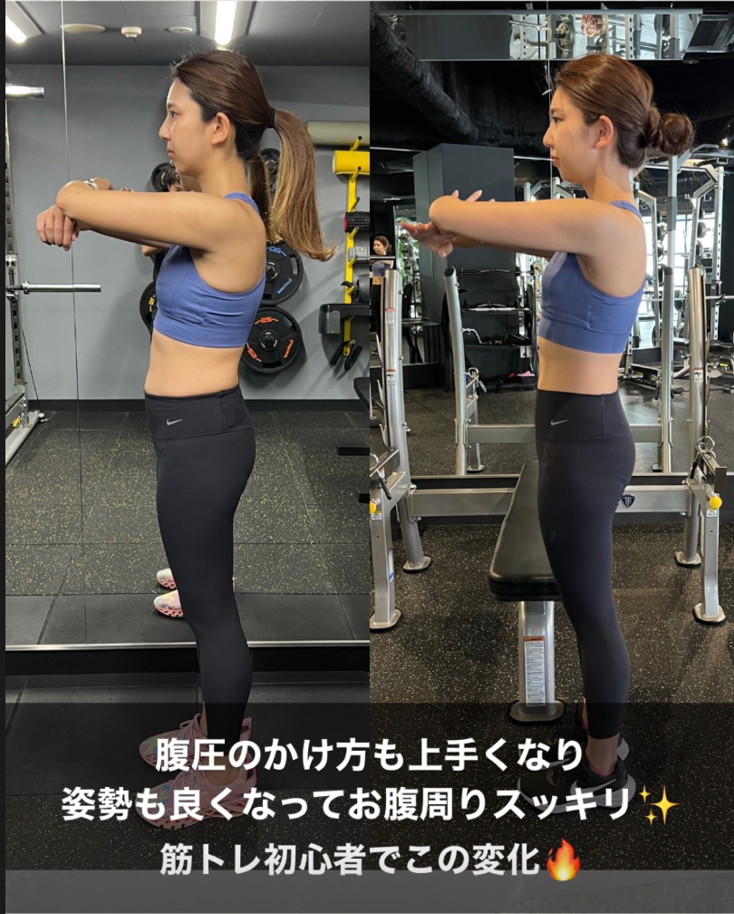 女性 姿勢改善 ビフォー 横向き